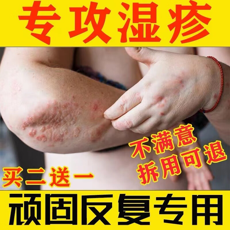 湿疹膏慢性湿疹皮肤瘙痒银屑湿疹专用膏荨麻诊手足湿疹湿痒脚痒脱 一