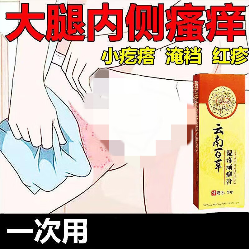 emeibao)走路磨腿大腿根磨伤胖人防磨腿烧裆大腿内侧摩擦红肿疼痛瘙痒