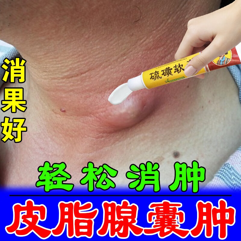 京东官方旗舰店自营皮脂腺囊肿i膏皮下囊肿粉瘤克星火疖子脓包拔毒消