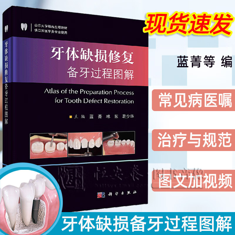 现货速发附视频讲解牙体缺损修复备牙过程图解蓝菁牙全瓷冠贴面牙齿