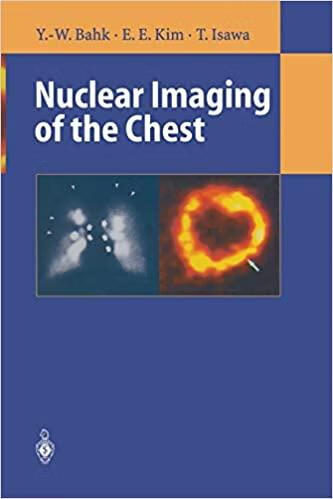 预订 nuclear imaging of the chest