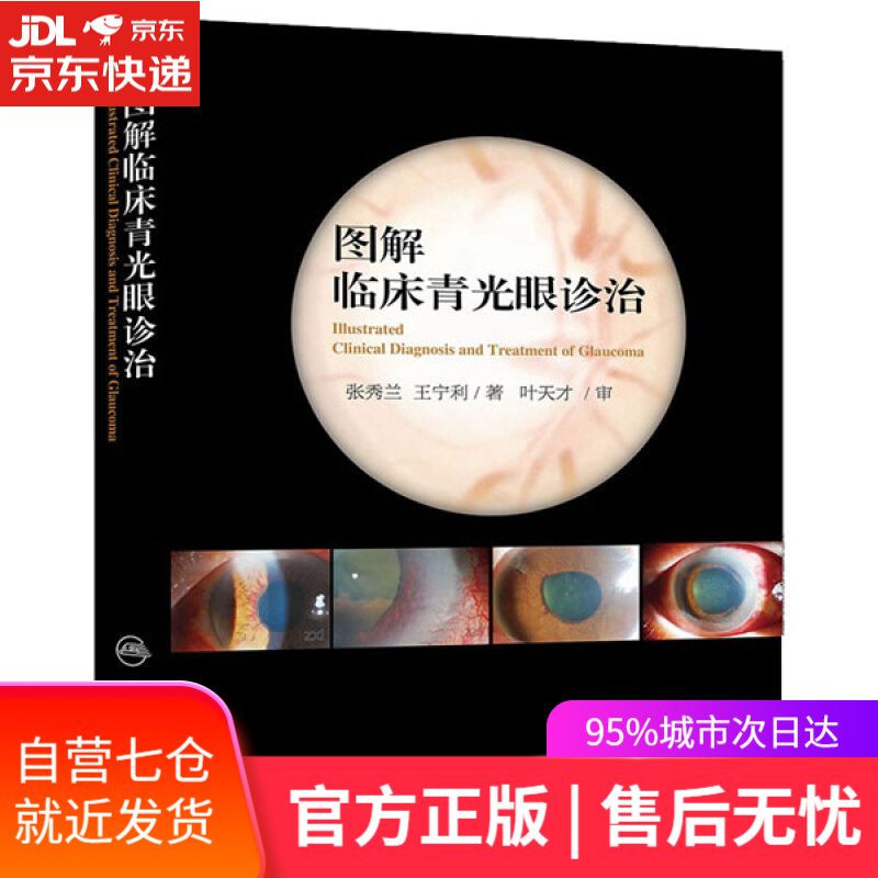 【新华书店】图解临床青光眼诊治 张秀兰,王宁利著 人民卫生出版社