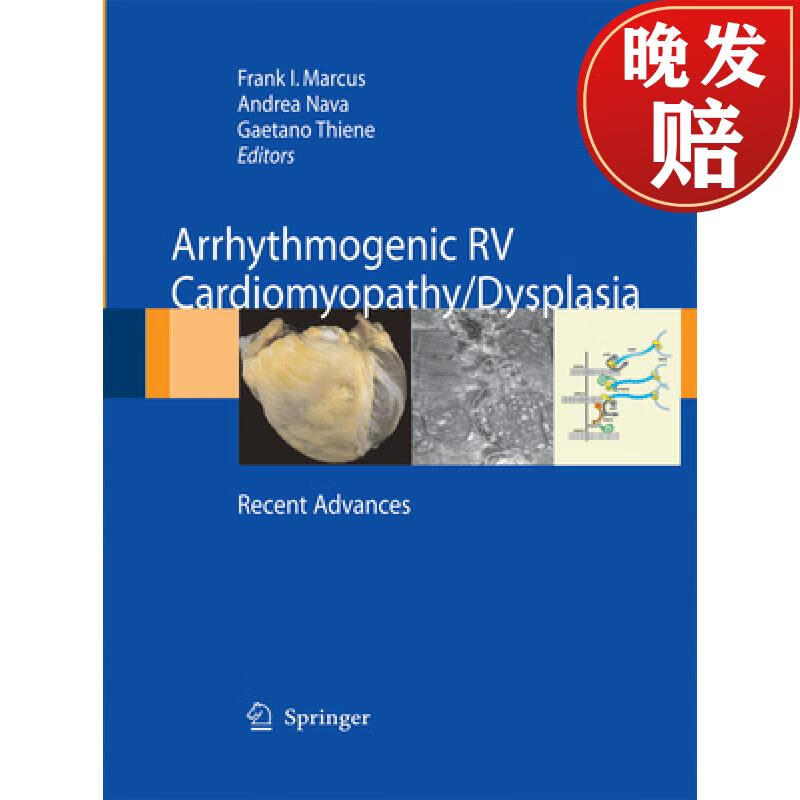 【4周达】arrhythmogenic rv cardiomyopathy/dysplasia: recent