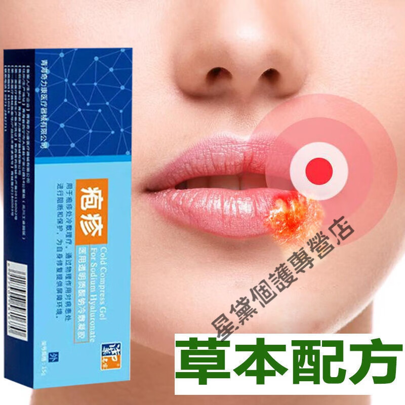 郁笙香 【官方】嘴唇起泡烂嘴角起水泡嘴巴上火嘴巴脓疮上火发痒溃烂