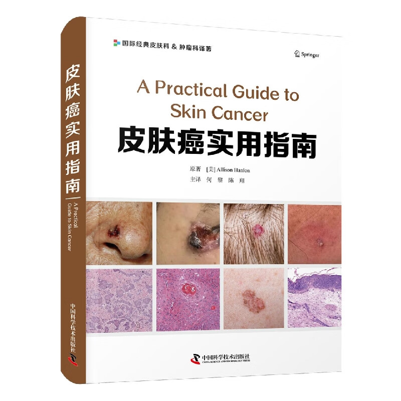 皮肤癌实用指南