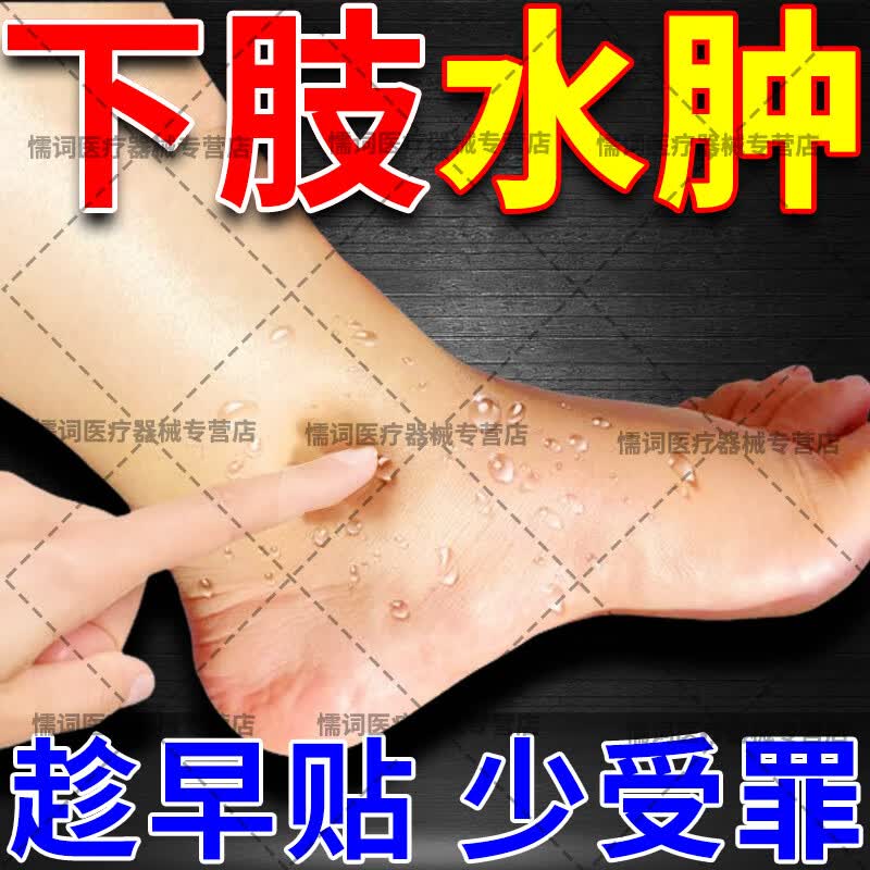 水肿消肿专用老年人浮肿下肢水肿腿肿脚肿药消肿贴水肿消除贴利尿消