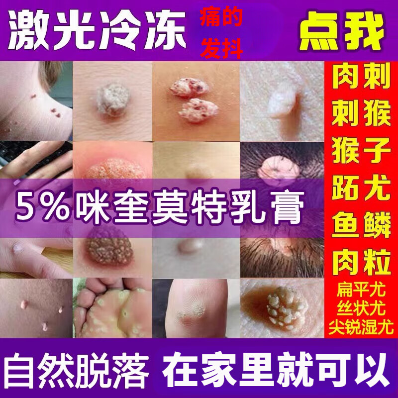 克尤膏扁平疣克疣净去猴子脖子肉粒温和不留巴肉刺膏扁平疣一抹灵 1盒