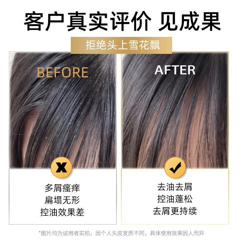 采乐酮康去屑洗发水止痒控油柔顺洗发露去头皮清洁洗头清爽去头屑男女 【去屑止痒】750ml+送40ml
