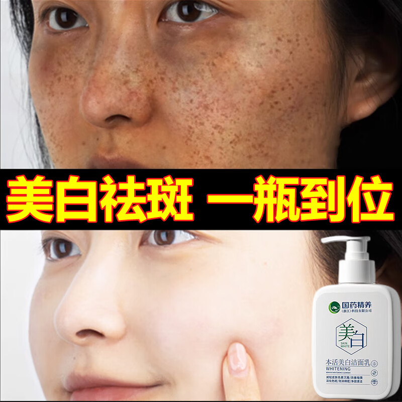 国药精养美白洗面奶氨基酸洁面乳祛斑控油抗痘收缩毛孔保湿清洁男士150ML
