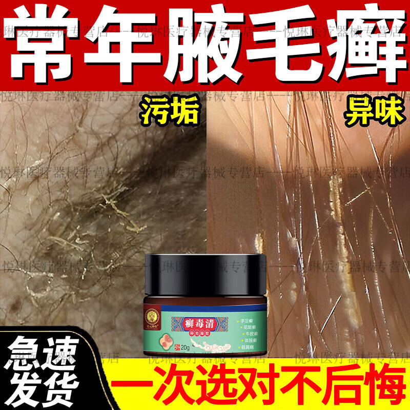 腋毛癣腋毛癣去腋下腋毛附着物污渍污垢白色结晶物腋下出汗异味腋 单