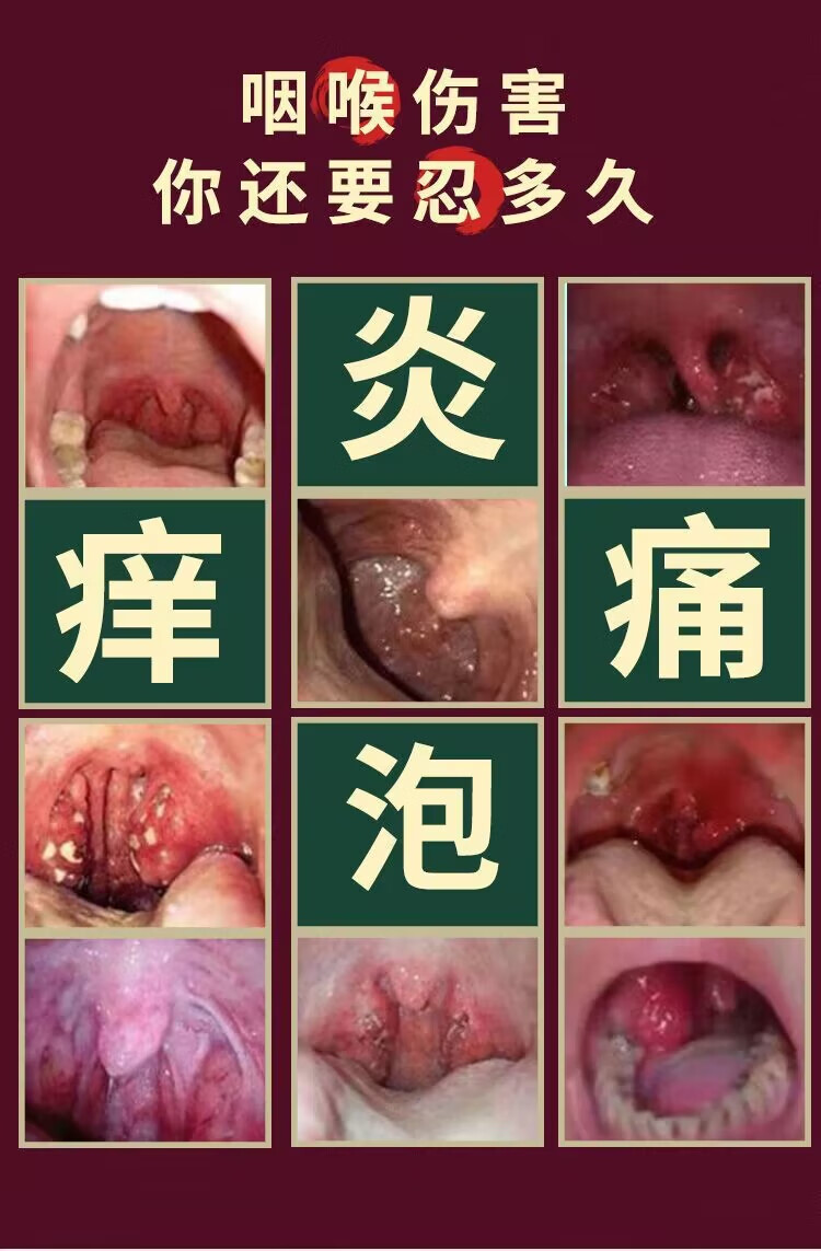 永森堂蜂胶咽喉炎喷剂慢性咽喉克异物感干呕喉咙肿痛干痒嘶哑止滤泡咳 买3+2【五盒巩固装】
