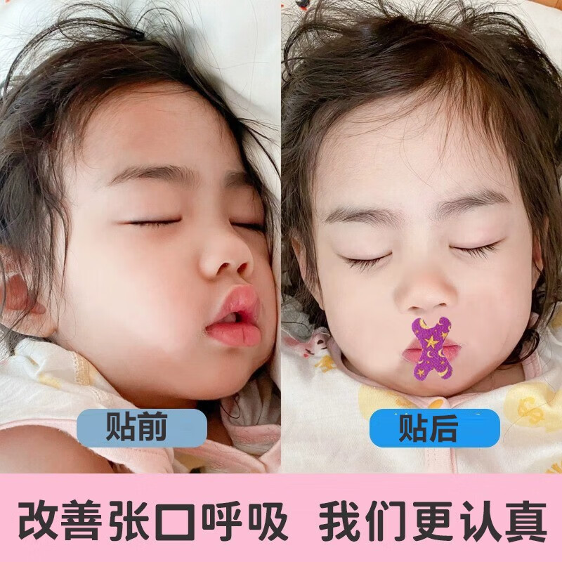 闭嘴贴呼吸张嘴呼吸睡觉打鼾封口贴腺样体肥大口鼻嘴唇睡觉 单盒装