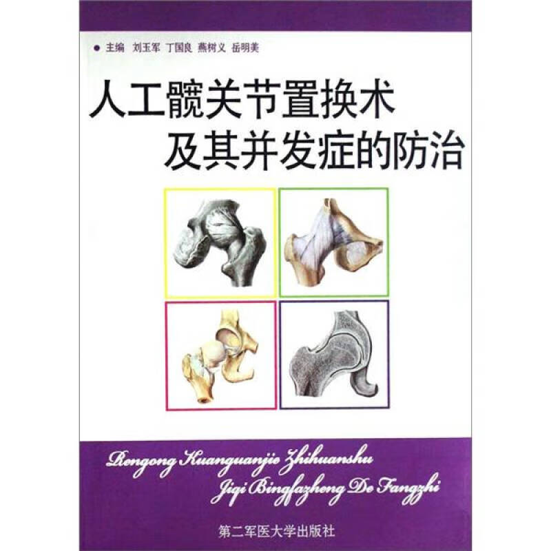 人工髋关节置换术及其并发症的防治【正版精选】