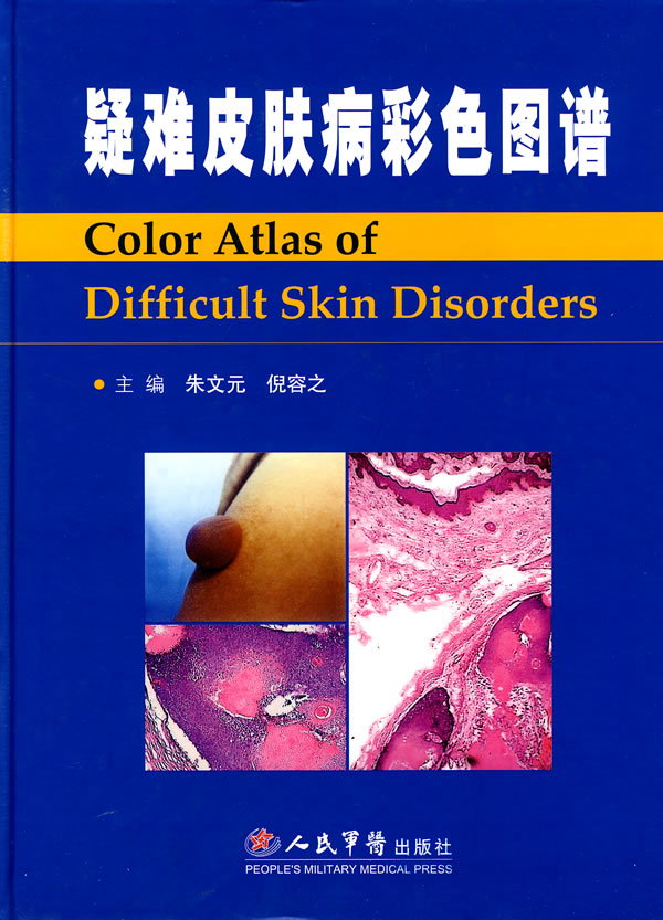 疑难皮肤病彩色图谱【正版书籍】