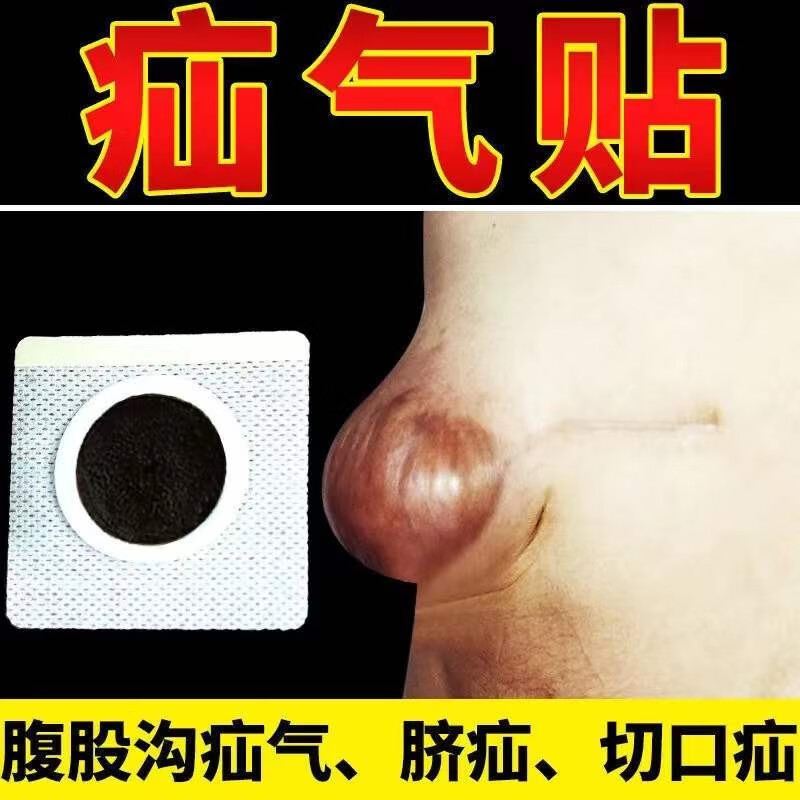 疝气救星中老年腹壁薄肥胖疝气贴中年治腹疝沟疝气治疝气疝气贴贴膏