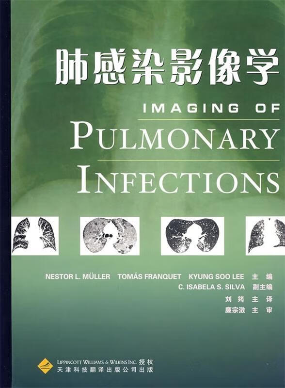 肺感染影像学 米勒等编,刘筠 译 9787543322448