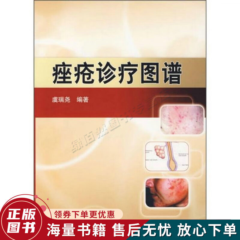 痤疮诊疗图谱