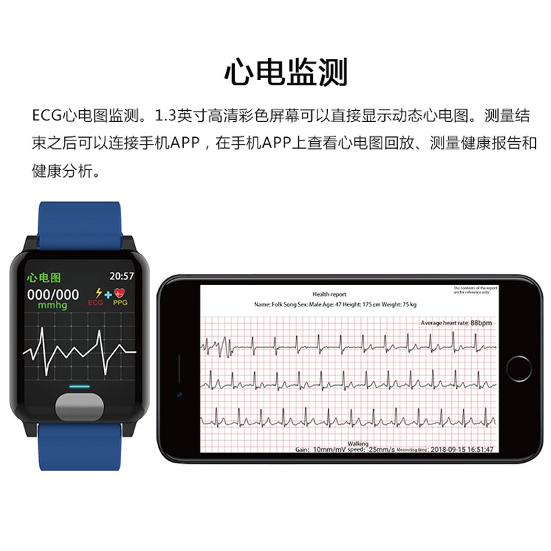 DMDG智能手环心电彩屏款远程关爱功能可以看到血压吗？