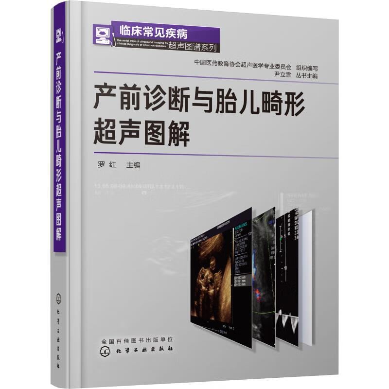 产前诊断与胎儿畸形超声图解
