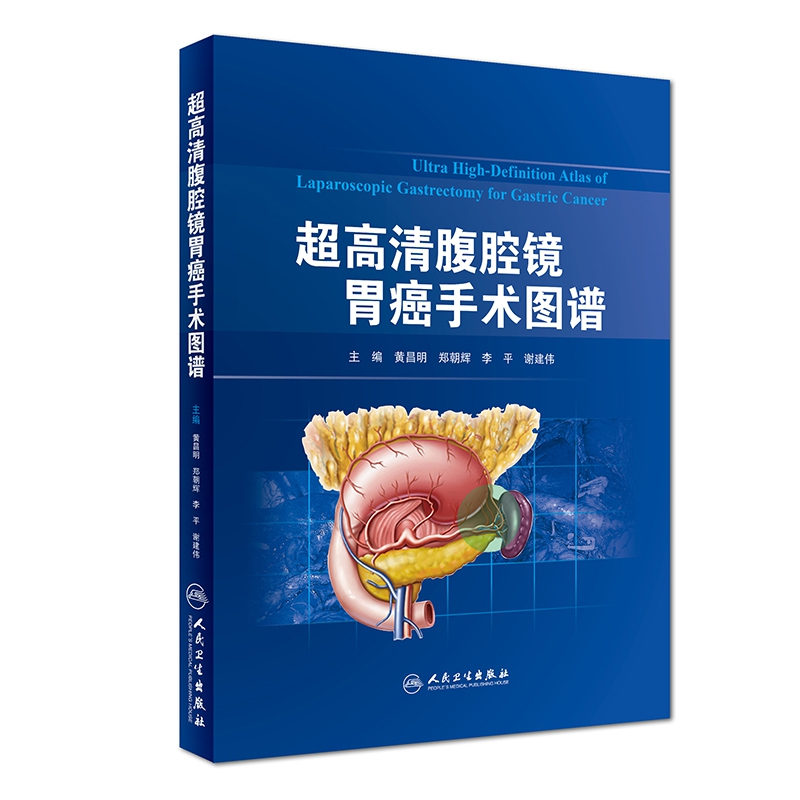 超高清腹腔镜胃癌手术图谱(精)