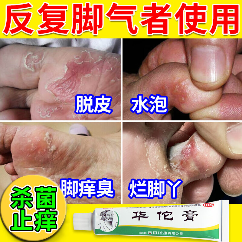 脚出汗 华佗膏 3盒【脚趾瘙痒】推荐多盒疗程使用 收藏加购 优先发货