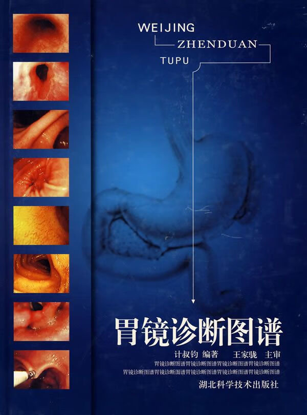 胃镜诊断图谱