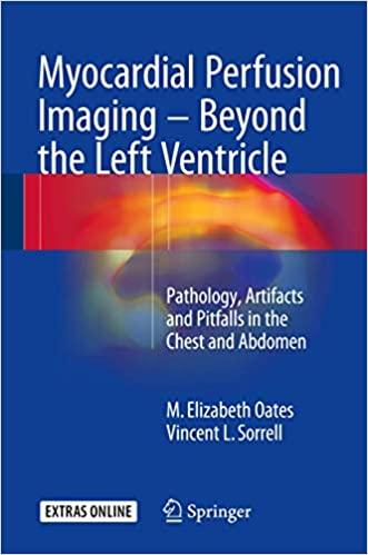 预订 myocardial perfusion imaging - beyond the left ventricle