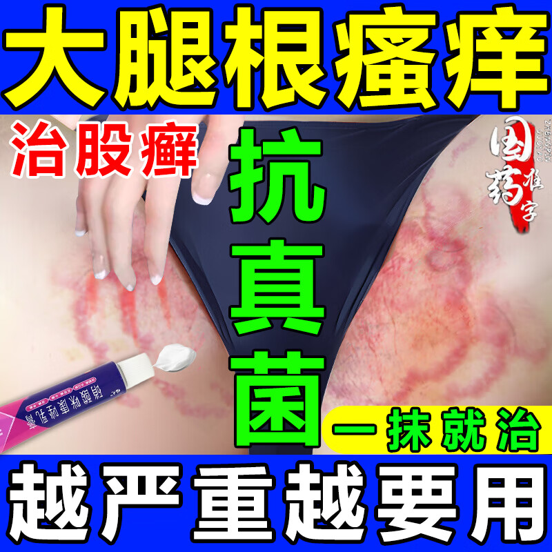 皮肤癣止痒杀菌 1盒装【股癣膏大腿内侧阴囊私处瘙痒异味变黑】