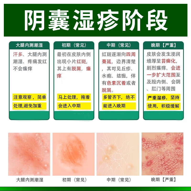 北京同仁堂阴囊湿疹喷雾 阴囊潮湿瘙痒男性阴部裆部潮湿潮热会阴部大腿内侧痒红肿脱皮干裂皮炎湿疹专用喷剂 1盒装30ml