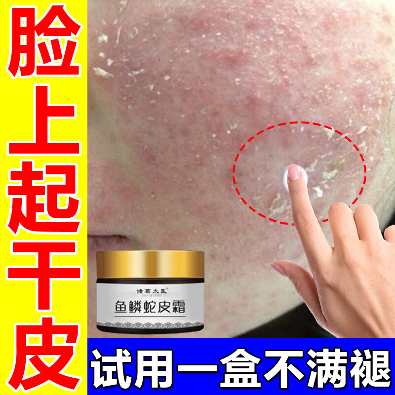 面部皮肤干燥起皮脸上鼻翼脱皮掉皮有碎屑过敏红痒皮炎四季面部缺水
