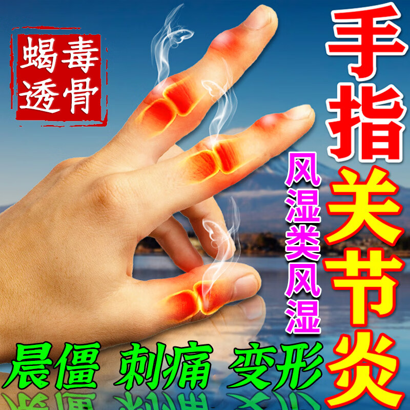 风湿止痛膏药类风湿性骨手指肿大肿胀疼痛专用变形药贴消肿 手肿疼痛