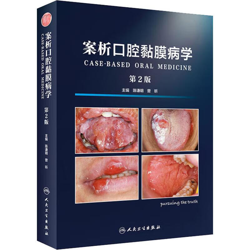 案析口腔黏膜病学 第2版