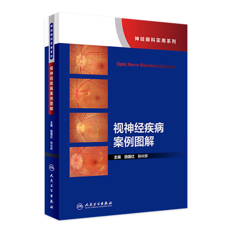 视神经疾病案例图解（神经眼科实用系列）