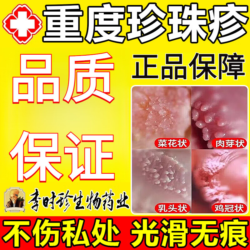 李时珍珍珠疹去除药品男性冠状沟珍珠疹龟头包皮炎专的用药真菌感染