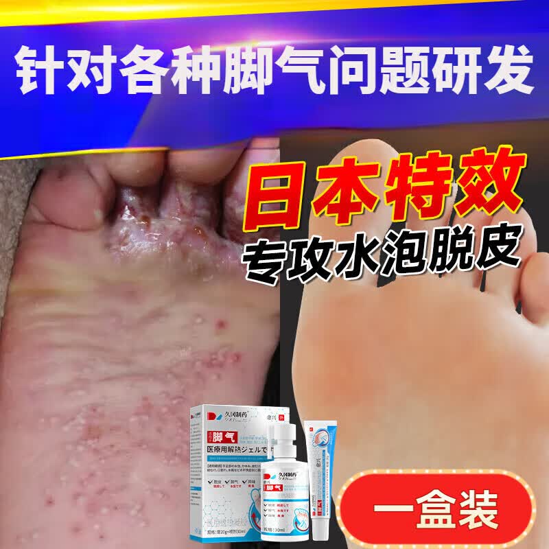 熏姿颜索见达素喷剂喷雾臭i烂脚丫脱皮糜烂脚趾缝烂痒脱皮止痒膏 一盒