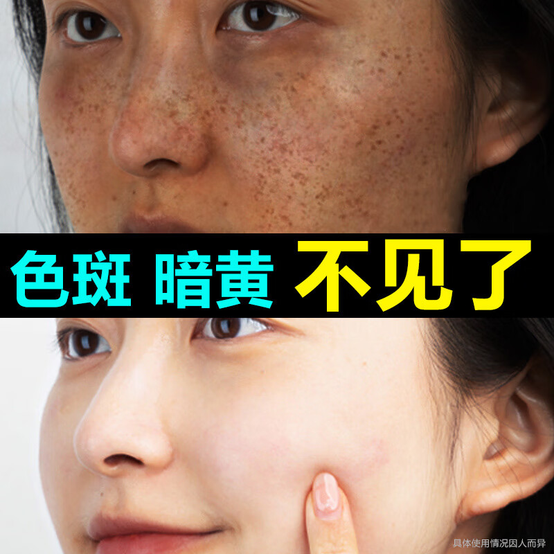 南京同仁堂美白祛斑霜淡化黑色素去雀斑老年黄褐斑晒斑去斑烟酰胺淡斑30g/瓶