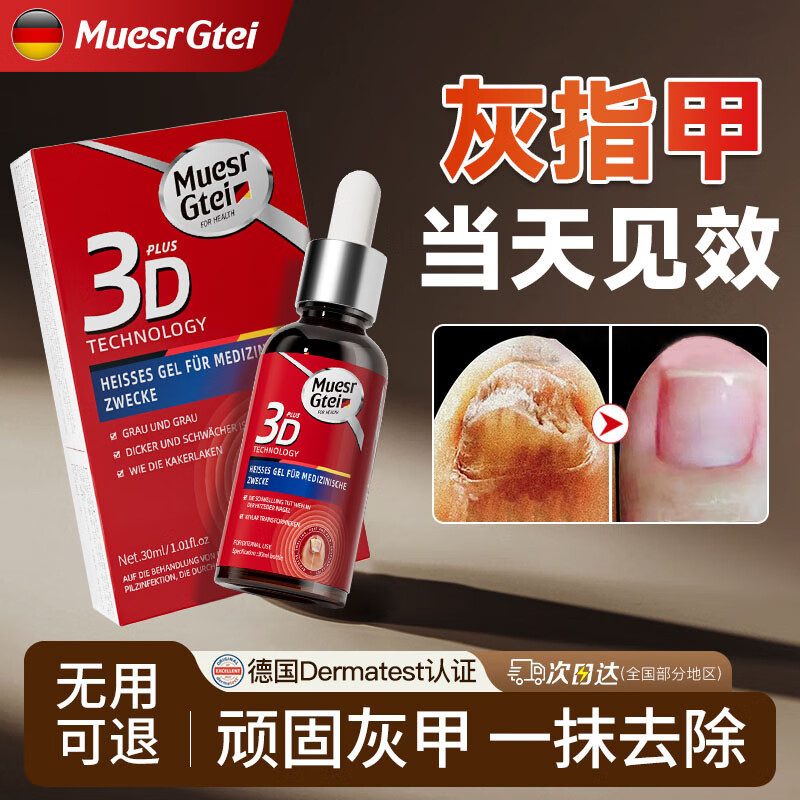 MUESRGTEI德国高端进口灰指甲特殊效去除增厚发黄变空液中草药水灰甲 一盒装【1-2个推荐】
