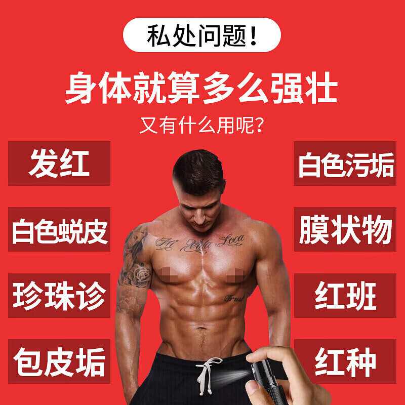 纾大夫龟头炎包皮炎专用阴囊潮湿瘙痒红肿异味红点白点念珠菌药喷雾剂 三支周期装(两支价)