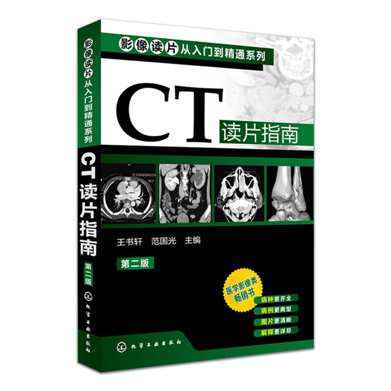 影像读片从入门到精通系列:CT读片指南第2版作者：范国光，王书轩 主编化学工业出版社