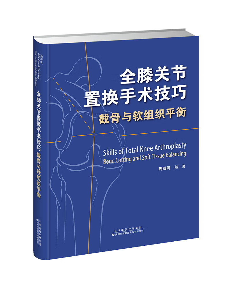 全膝关节置换手术技巧：截骨与软组织平衡