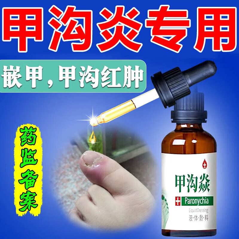 痛手脚趾灰指甲息肉芽液不往肉里长红肿发炎流脓化脓甲沟炎甲沟炎膏