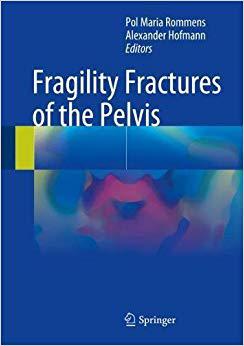 【预订】fragility fractures of the pelvis