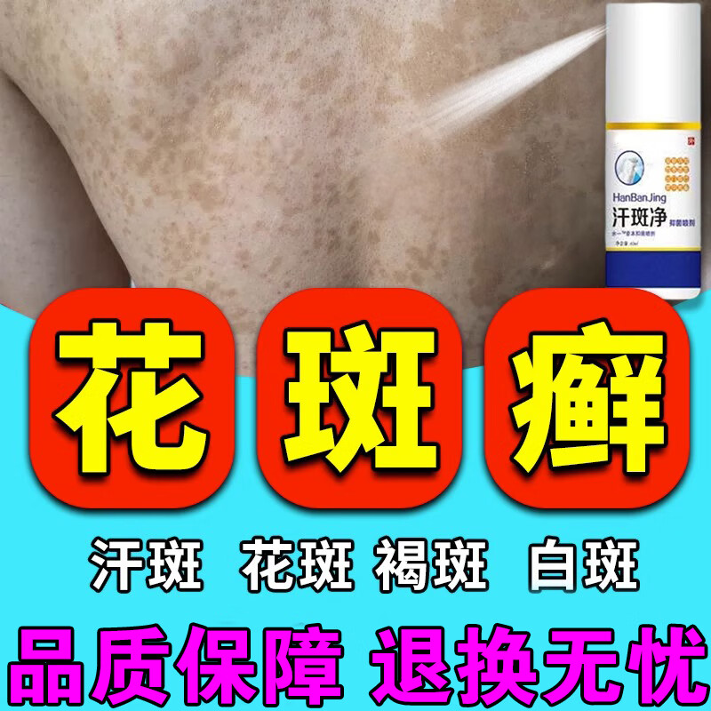 汗斑净专用喷雾药成人儿童汗斑花斑癣除汗根白斑褐斑糠疹皮肤瘙痒专用