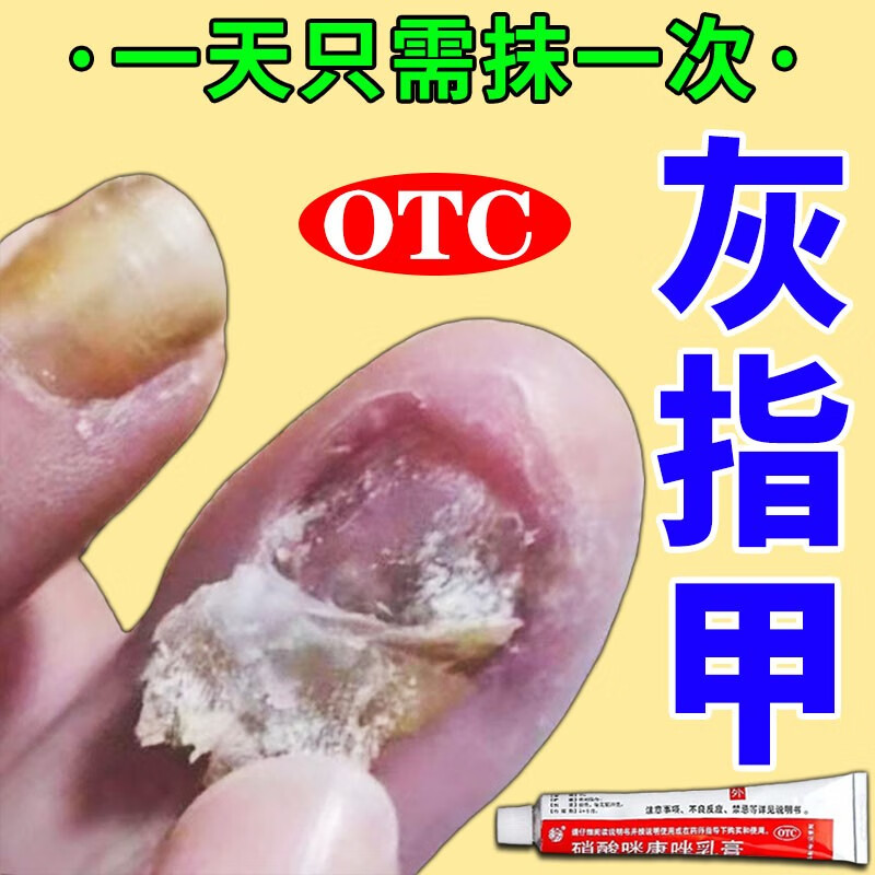硝酸咪康唑乳膏 灰指甲专用指甲真菌感染脱甲坏甲药灰指甲主图视觉