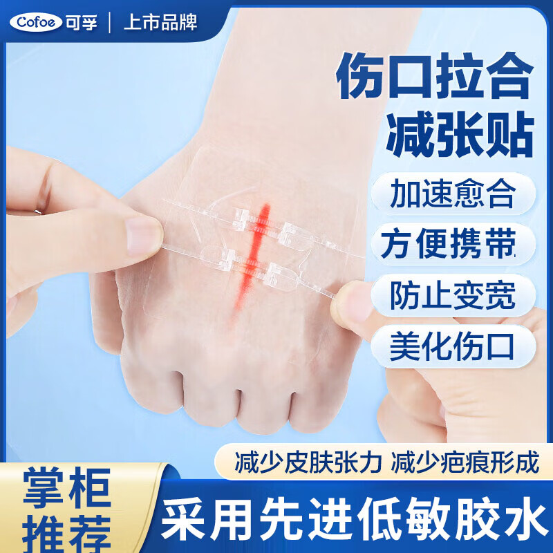 减张器皮肤便携装伤口愈合疤痕剖腹产粘性儿童术后拉链伤口贴减张贴