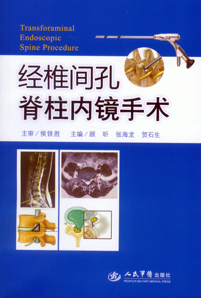 经椎间孔脊柱内镜手术