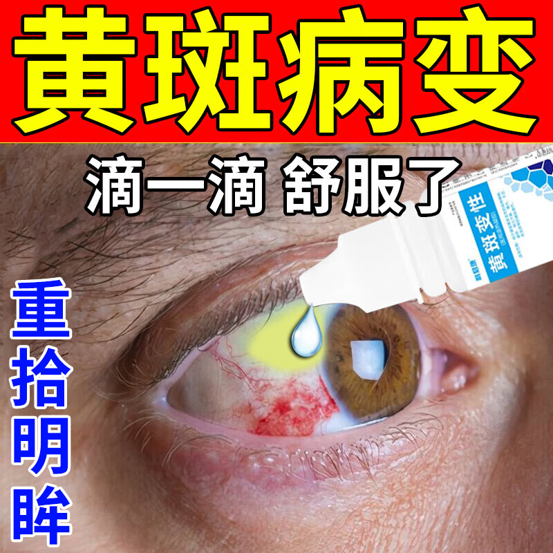 眼底发黄出血眼球浑浊视物模糊干涩畏光视物 视物扭曲变形 视力减退五