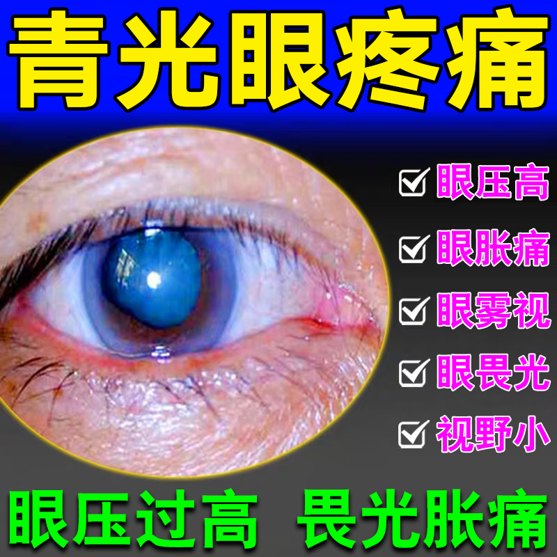 青光眼滴眼液降眼压用非药眼压高眼干涩疲劳畏光雾视胀痛酸痛视物模糊