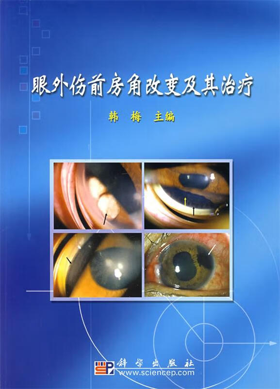 眼外伤前房角改变及其治疗 9787030189998 韩梅 主编 科学出版社