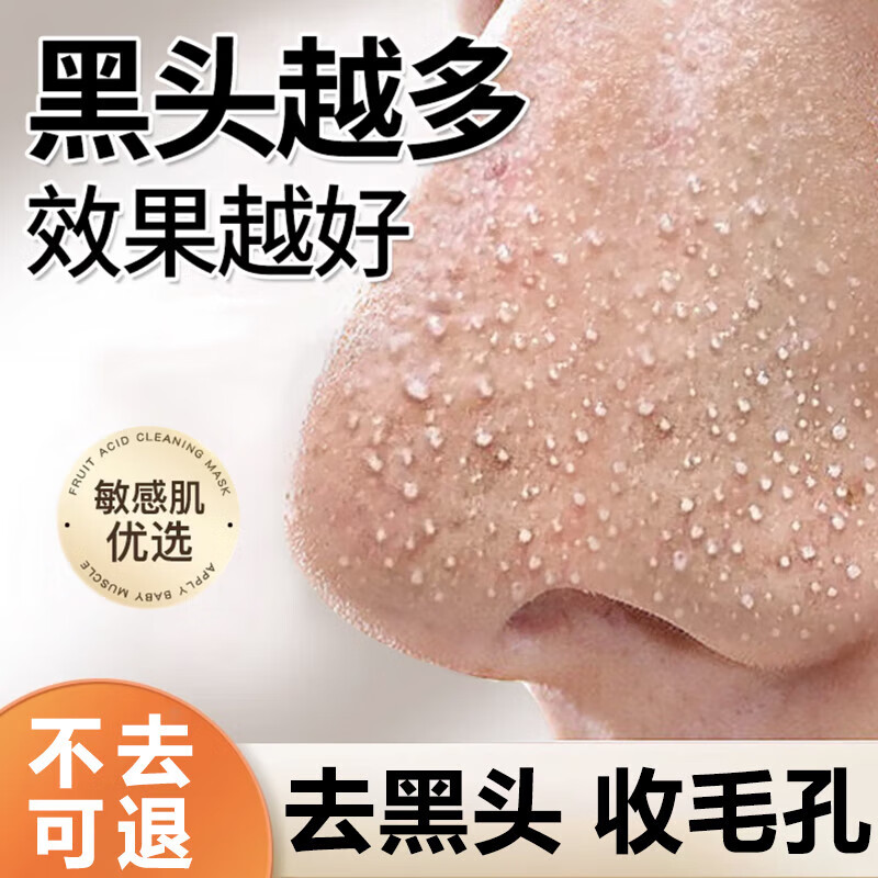 YMVLSD壬二酸紫苏清肤净颜泥膜棒去黑头粉刺收缩毛孔清洁涂抹面膜30g
